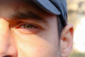 was hilft gegen geschwollene augen