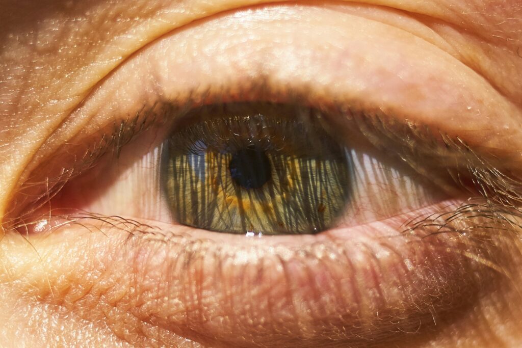 was hilft gegen ein geschwollenes auge