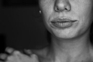 was hilft gegen trockene Lippen