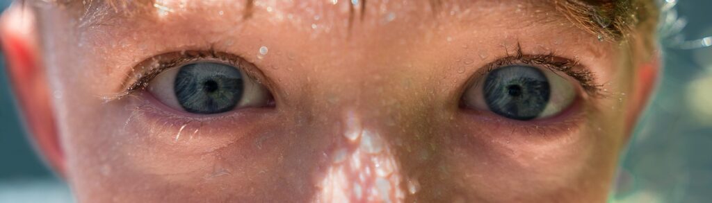 was hilft gegen geschwollene augen